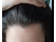 Пена Rogaine Регейн Миноксидил 5% средство для роста волос для женщин - #1 В США
