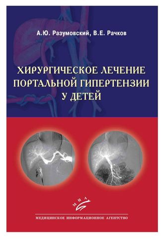 Хирургическое лечение портальной гипертензии у детей. Разумовский А.Ю., Рачков В.Е. &quot;МИА&quot;. 2012