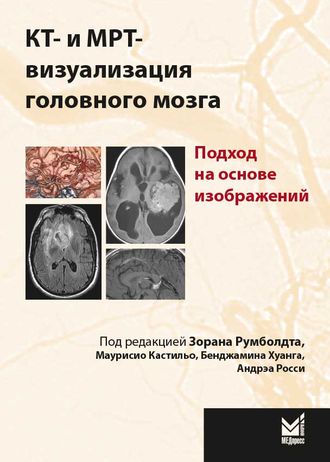 КТ- и МРТ-визуализация головного мозга. Подход на основе изображений. З. Румболдт, М. Кастильо, Б. Хуанг, А. Росси. &quot;МЕДпресс-информ&quot;. 2020