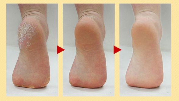Как пережить кризис в отношениях Искусство быть женщиной