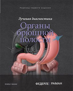 Лучевая диагностика. Органы брюшной полости. М. П. Федерле, Ш. П. Раман и др. Издательство Панфилова&quot;. 2019