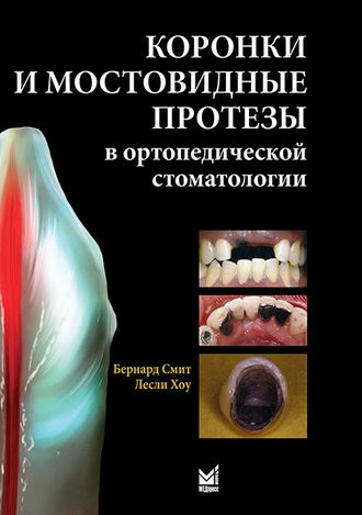 Коронки и мостовидные протезы в ортопедической стоматологии. Смит Б., Хоу Л.&quot;МЕДпресс-информ&quot;. 2010