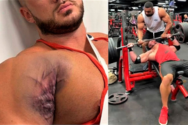 Лечение сухожилий