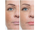 Упругость, омоложение, и влажнение кожи: Мезороллер (540 игл) + Коллаген "Oringinal fluid" 100% - (10ml) + Альгинатная Маска для лица Collagen