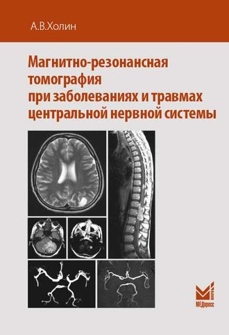 Магнитно-резонансная томография при заболеваниях и травмах центральной нервной системы.	Холин А.В. &quot;МЕДпресс-информ&quot;. 2017