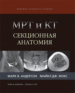 МРТ и КТ. Секционная анатомия. Марк В. Андерсон, Майкл Дж. Фокс. Издательство Панфилова&quot;. 2018