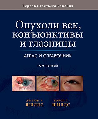 Опухоли век, конъюнктивы и глазницы. Атлас и справочник: в двух томах. Том 1. Джерри А. Шилдс, Кэрол Л. Шилдс. &quot;Издательство Панфилова&quot;. 2017