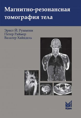 Магнитно-резонансная томография тела. 3-е издание. Э.Й.Руммени. &quot;МЕДпресс-информ&quot;. 2022