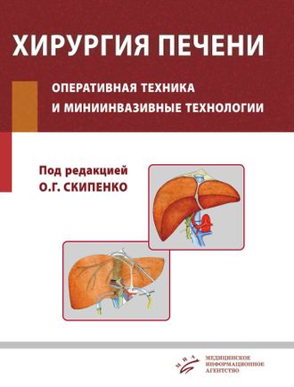 Хирургия печени. Оперативная техника и миниинвазивные технологии. Руководство. Скипенко О.Г. &quot;МИА&quot; (Медицинское информационное агентство). 2016