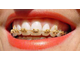 Зубная паста ортодонтическая c яблочно-мятным вкусом Vitis Orthodontic, Dentaid, 100 мл.