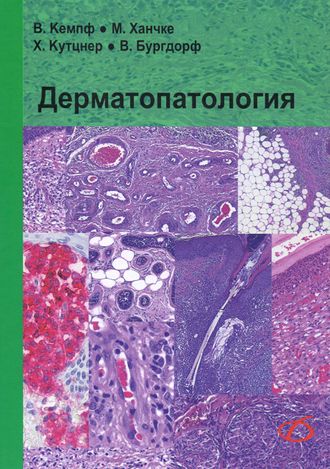 Дерматопатология. Кемпф В., Ханчке М., Кутцнер Х., Бургдорф В. &quot;Медицинская литература&quot;. 2015