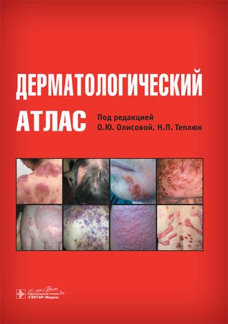 Дерматологический атлас. Под ред. О.Ю. Олисовой, Н.П. Теплюк. &quot;ГЭОТАР-Медиа&quot;. 2015