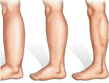Лечение отёчности ног :: стоп, коленей, щиколоток