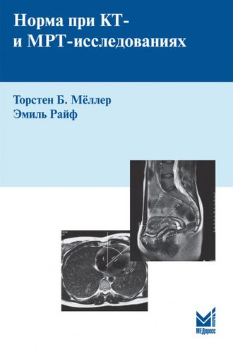 Норма при КТ- и МРТ-исследованиях. 5-е издание. Мёллер Т.Б., Райф Э. &quot;МЕДпресс-информ&quot;. 2022