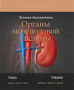 Лучевая диагностика. Органы мочеполовой системы. Т. Тублин, А. А. Борхани, А. Фурлан, М. Т. Хеллер. &quot;Издательство Панфилова&quot;. 2018