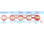 Пародонтология (лечение десен)