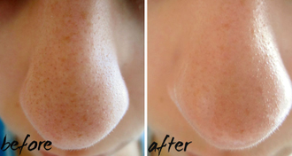 Nose Care Liquid для сужения пор на носу (10 ml). Глубокого проникновения. Двойной эффект: сужение пор и контроль уровня секреции сальных желез ( анти- акне)