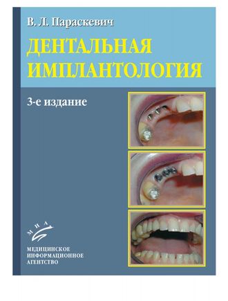 Дентальная имплантология: Основы теории и практики. 3-е изд. Параскевич В.Л. &quot;МИА&quot; (Медицинское информационное агентство). 2011