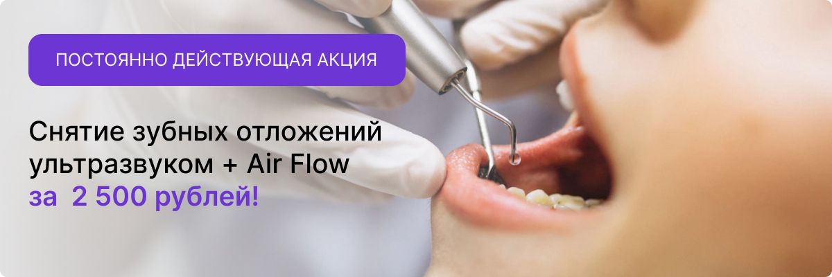 Air Flow за 1500 рублей