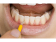 Межзубные ершики Dental Brush L, 0,7 мм, желтые, Plackers,  24 шт.
