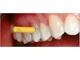 Межзубные ершики Dental Brush M, 0,6 мм, синие,  Plackers, 24 шт.