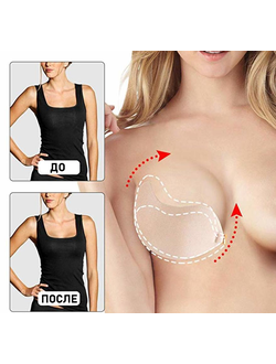 Подтяжка груди и улучшение формы без пластики с помощью силиконовых прозрачных наклеек.