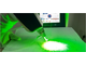 NV7 Неодимовый лазер для удаления татуировок и карбонового пилинга