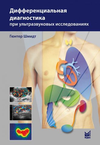 Дифференциальная диагностика при ультразвуковых исследованиях. 2-е издание. Г. Шмидт. &quot;МЕДпресс-информ&quot;. 2020