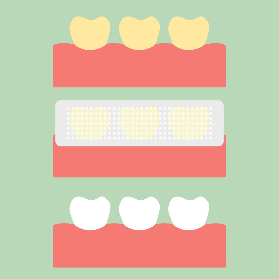 Выбираем отбеливающие полоски для зубов безопасные 3d white