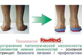 СТЕЛЬКИ ИНДИВИДУАЛЬНЫЕ    (до 35р-ра)