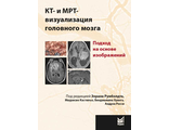 КТ- и МРТ-визуализация головного мозга. Подход на основе изображений. З. Румболдт, М. Кастильо, Б. Хуанг, А. Росси. &quot;МЕДпресс-информ&quot;. 2020