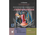 Диагностическая визуализация в гинекологии. Том 2. Шаабан А.М. &quot;МЕДпресс-информ&quot;. 2018