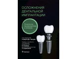 Осложнения дентальной имплантации. Этиология, профилактика и лечение. Фроум С. Дж. &quot;ГЭОТАР-Медиа&quot;. 2021