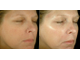 Упругость, регенерация и омоложение кожи: гиалуроновая кислота с биозолотом и альгинатная маска для лица