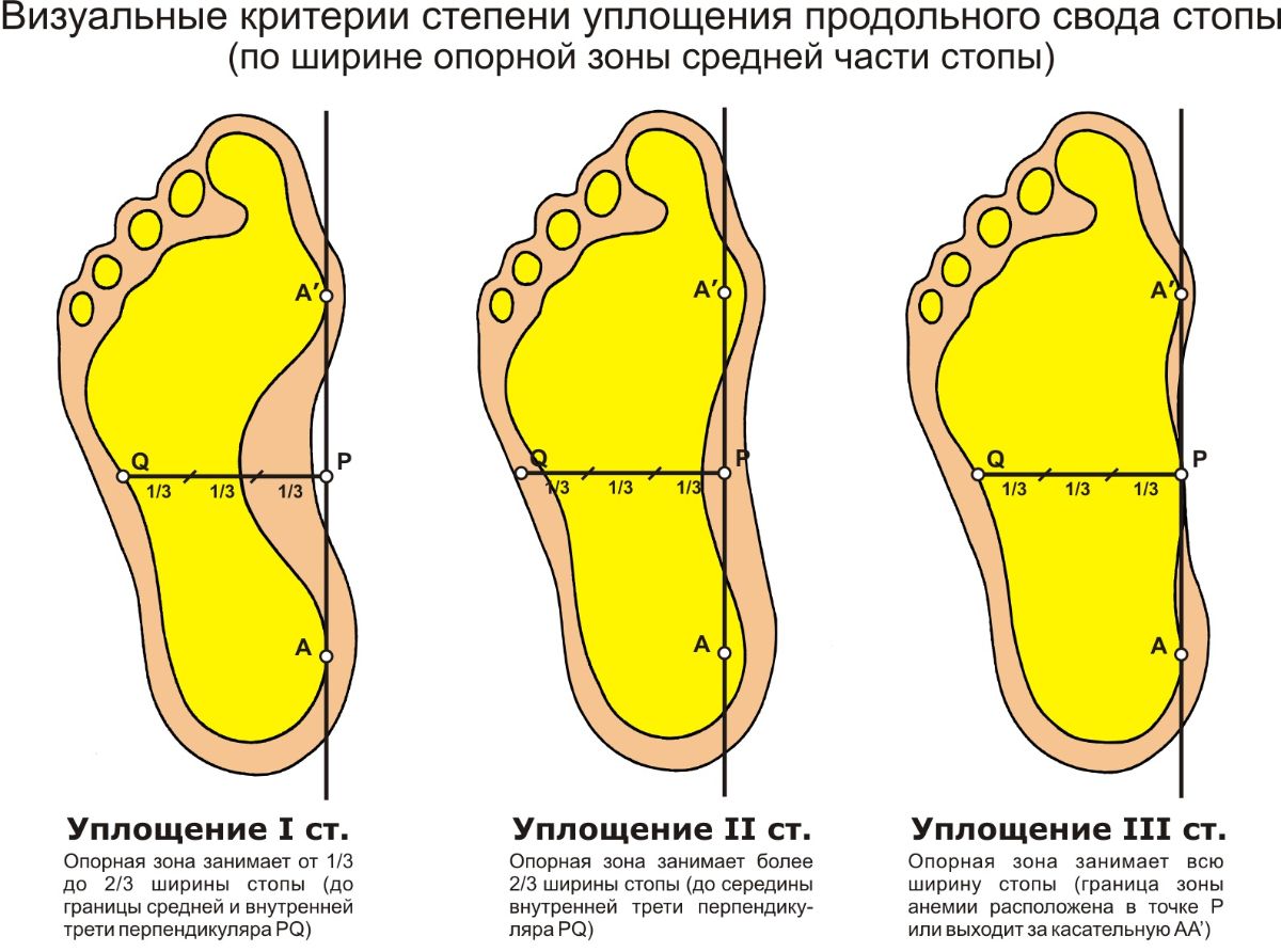 Установление свода