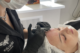 Биоревитализация