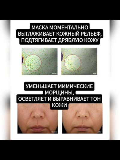 RE-MERGE Эксклюзивная маска - корсет от птоза, брылей, второго подбородка 4шт.