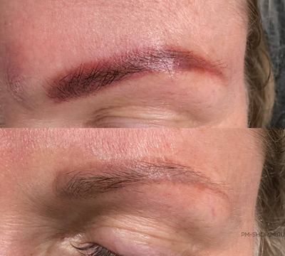 Онлайн-курс по удалению перманентного макияжа Pro Ремуверы от zero-pmu.ru