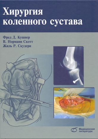 Хирургия коленного сустава. Кушнер Ф. Д., Скотт В. Н., Скудери Ж. Р. &quot;Медицинская литература&quot;. 2014