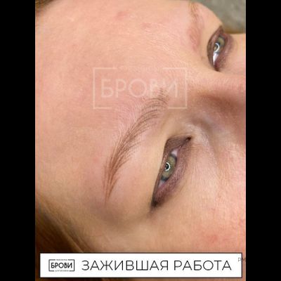 Брови. Веснушка