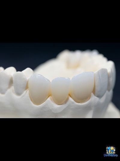 YUCERA 4D Pro Zirconia - Инновационный цирконий с четырьмя измерениями