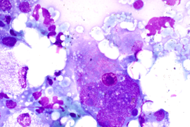 Цитологическая диагностика метастазов (онлайн курс)