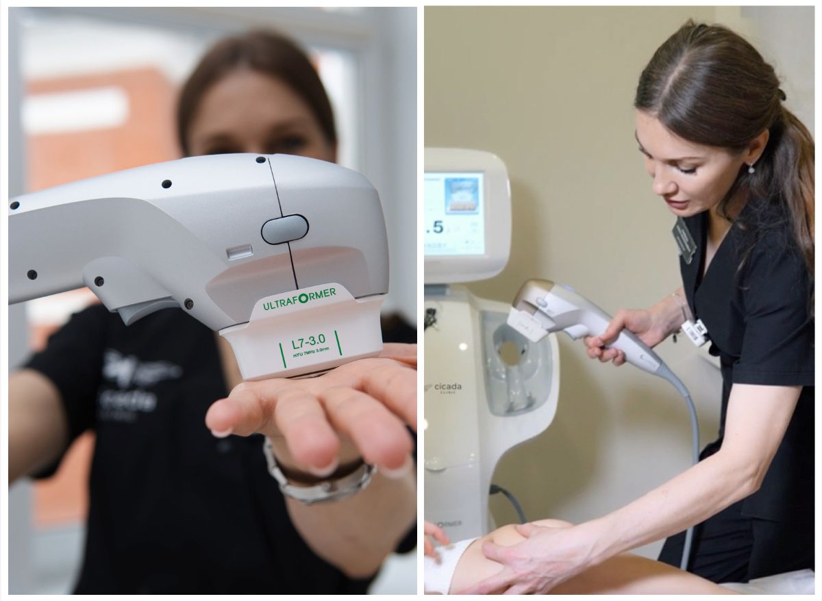 Smas-лифтинг Ultraformer Cicada Clinic