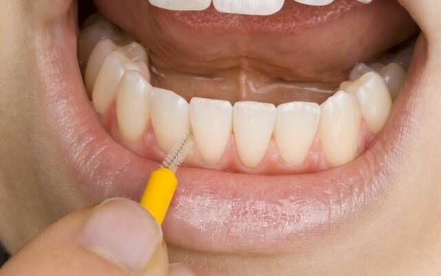 Межзубные ершики, розовый, Nano Interdental 0,8 мм, 5 штук, Pierrot , шт