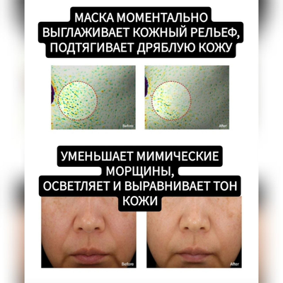 RE-MERGE Эксклюзивная маска - корсет от птоза, брылей, второго подбородка 4шт.