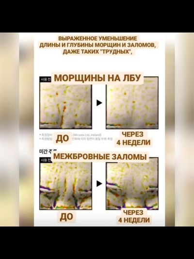 LABIOTTE Премиальные маски для тотального омоложения кожи 10шт.