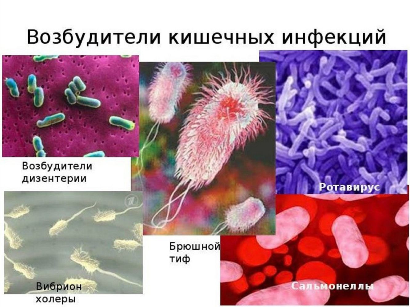 Микроорганизмы способные вызывать заболевания. Острые кишечные инфекции бактерии возбудители. Возбудители бактериальных инфекций бациллы. Микробы возбудители инфекционных заболеваний.