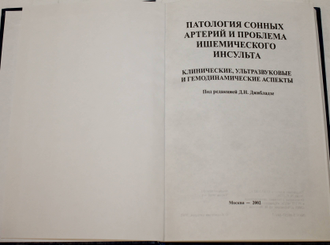 Патология сонных артерий и проблема ишемического инсульта. М. 2002.