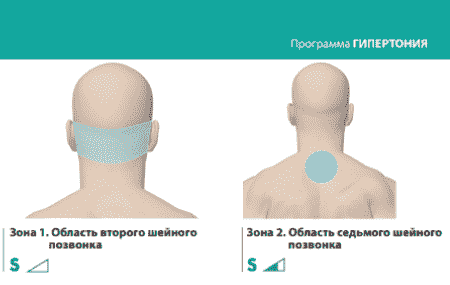 Программа «Гипертония». ДЭНАС-ПКМ | НЕЙРОДЭНС-ПКМ