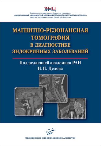 Магнитно-резонансная томография в диагностике эндокринных заболеваний. Воронцов А.В., Владимирова В.П., Бабаева Д.М., Дедов И.И. &quot;МИА&quot; (Медицинское информационное агентство). 2021